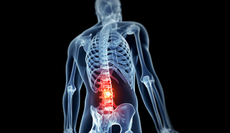changes in the lumbar spine in osteochondrosis