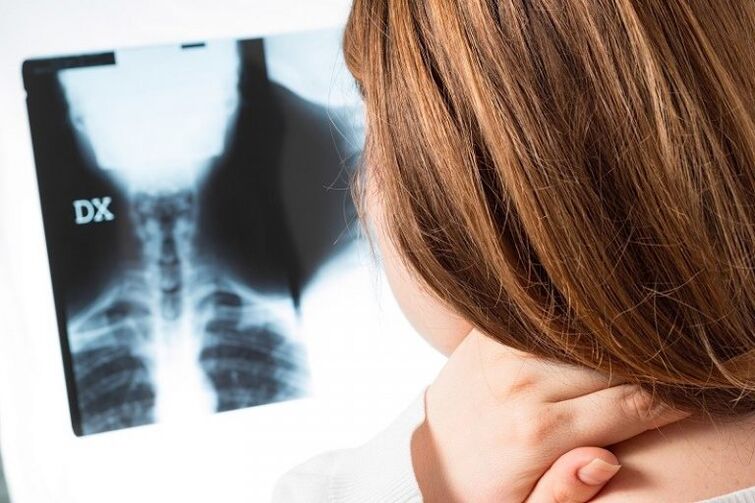 The cervical region X -Sugari