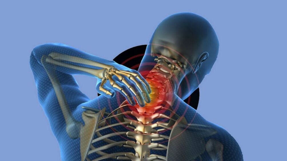 The cervical region osteochondrosis