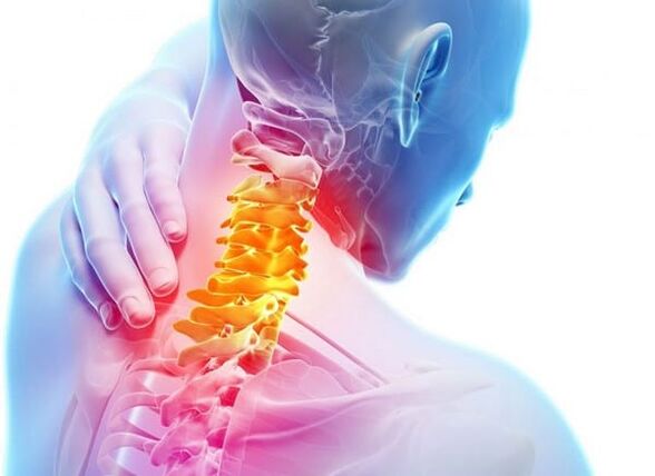 The cervical spine osteochondrosis