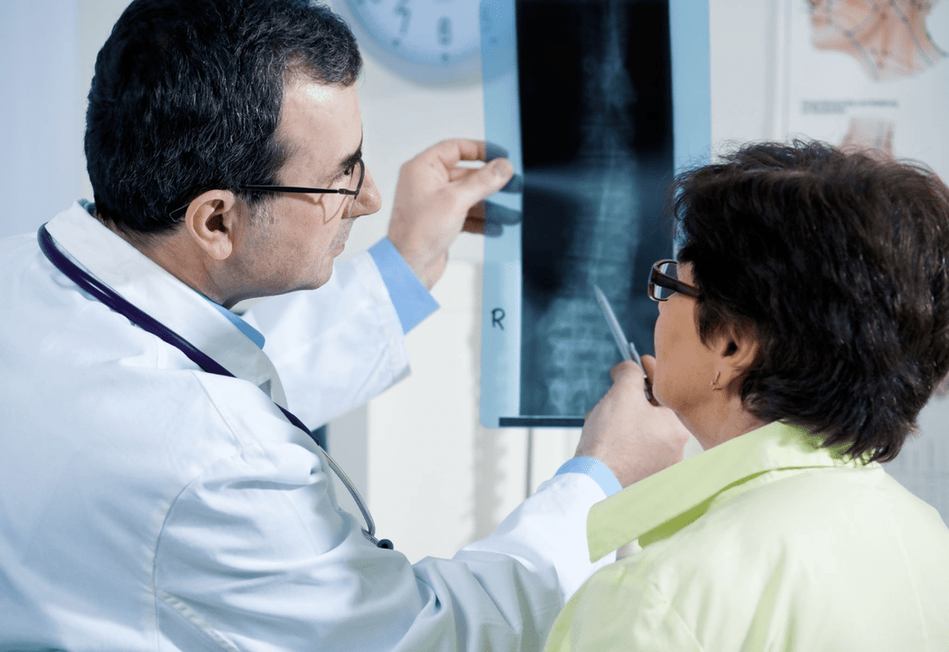 The neurologist diagnoses osteochondrosis by X-ray of the spine