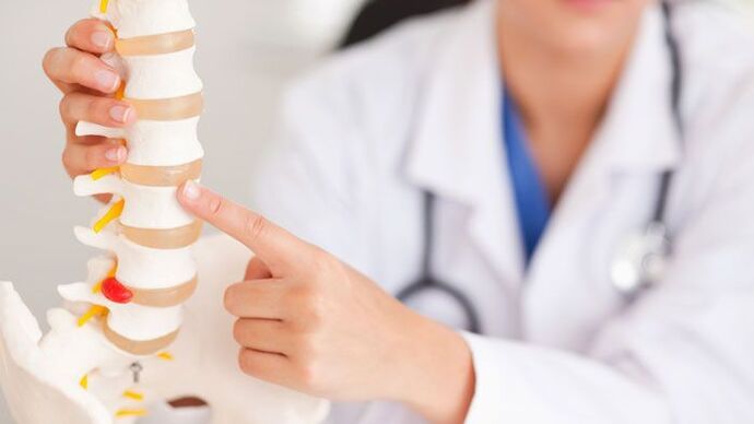 Explanation of lumbar osteochondrosis on the model of the spine